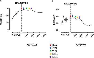 Case Report: Liraglutide for Weight Management in Beckwith-Wiedemann Syndromic Obesity